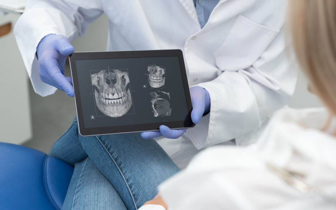 3D-Röntgen / DVT beim Zahnarzt: Unterschiede zum 2D-Röntgen