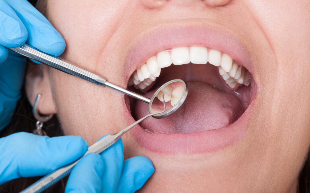 Caries diagnostics: what methods are available today?