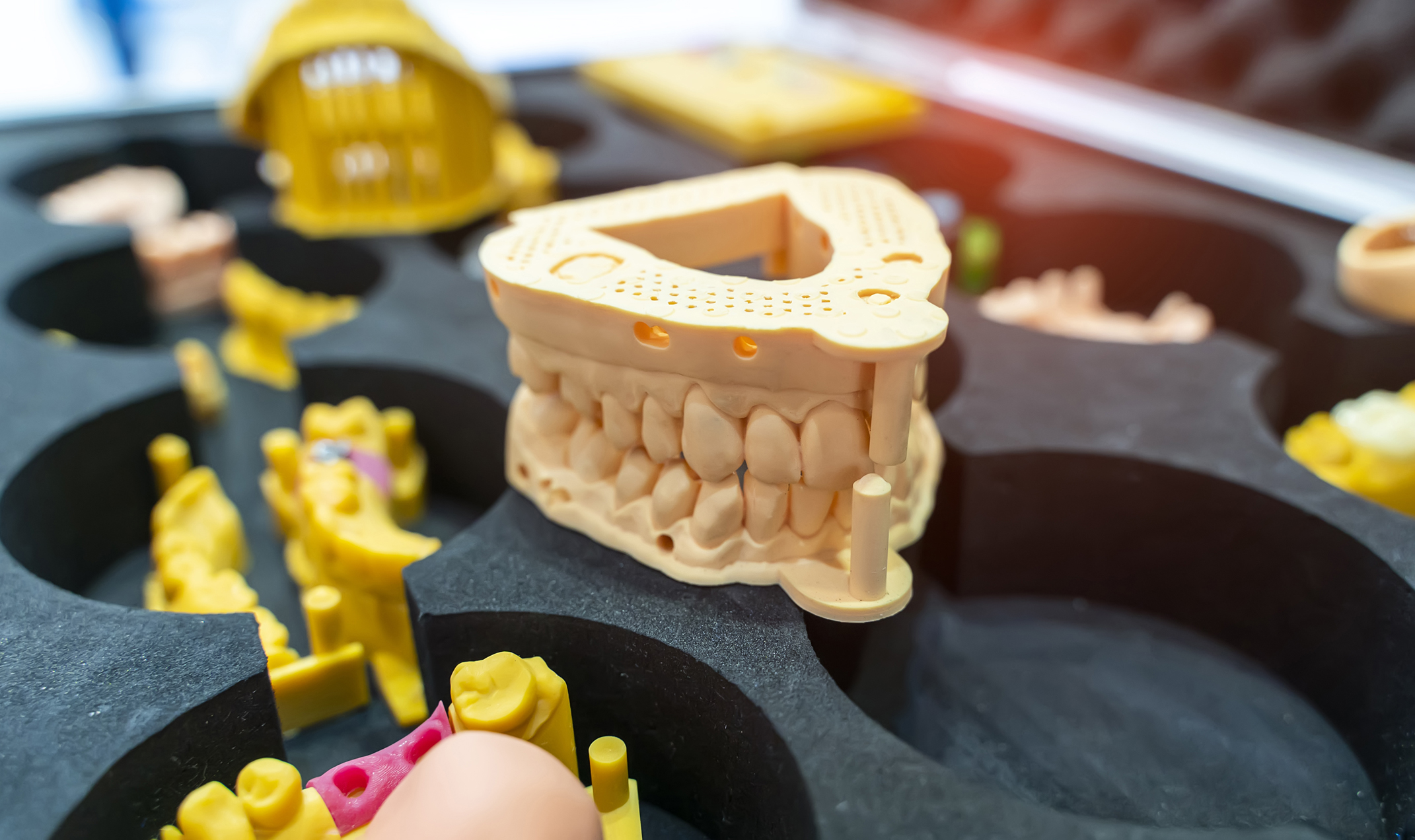3D-Druck Zahnmedizin Gebiss gedruckt